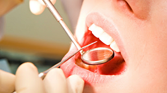 Рак полости рта: факторы риска и скрининг